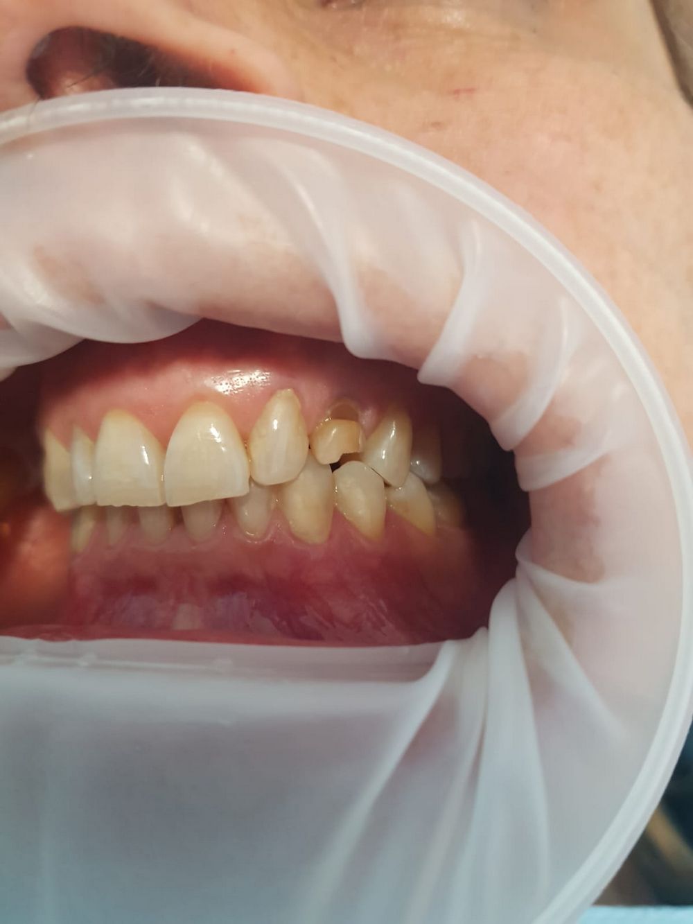 conservativa-endodonzia (1)