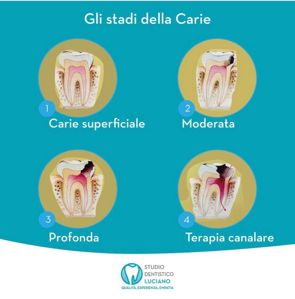 conservativa-endodonzia