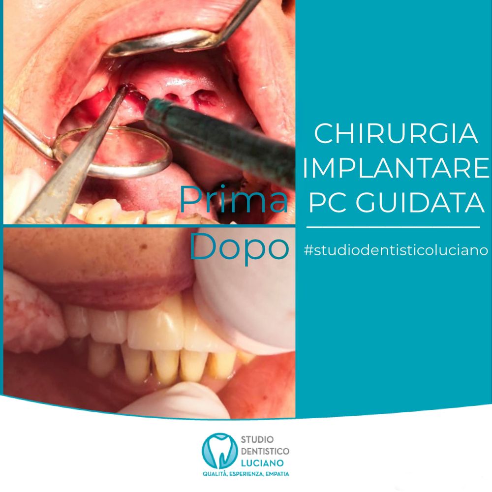 implantologia (2)