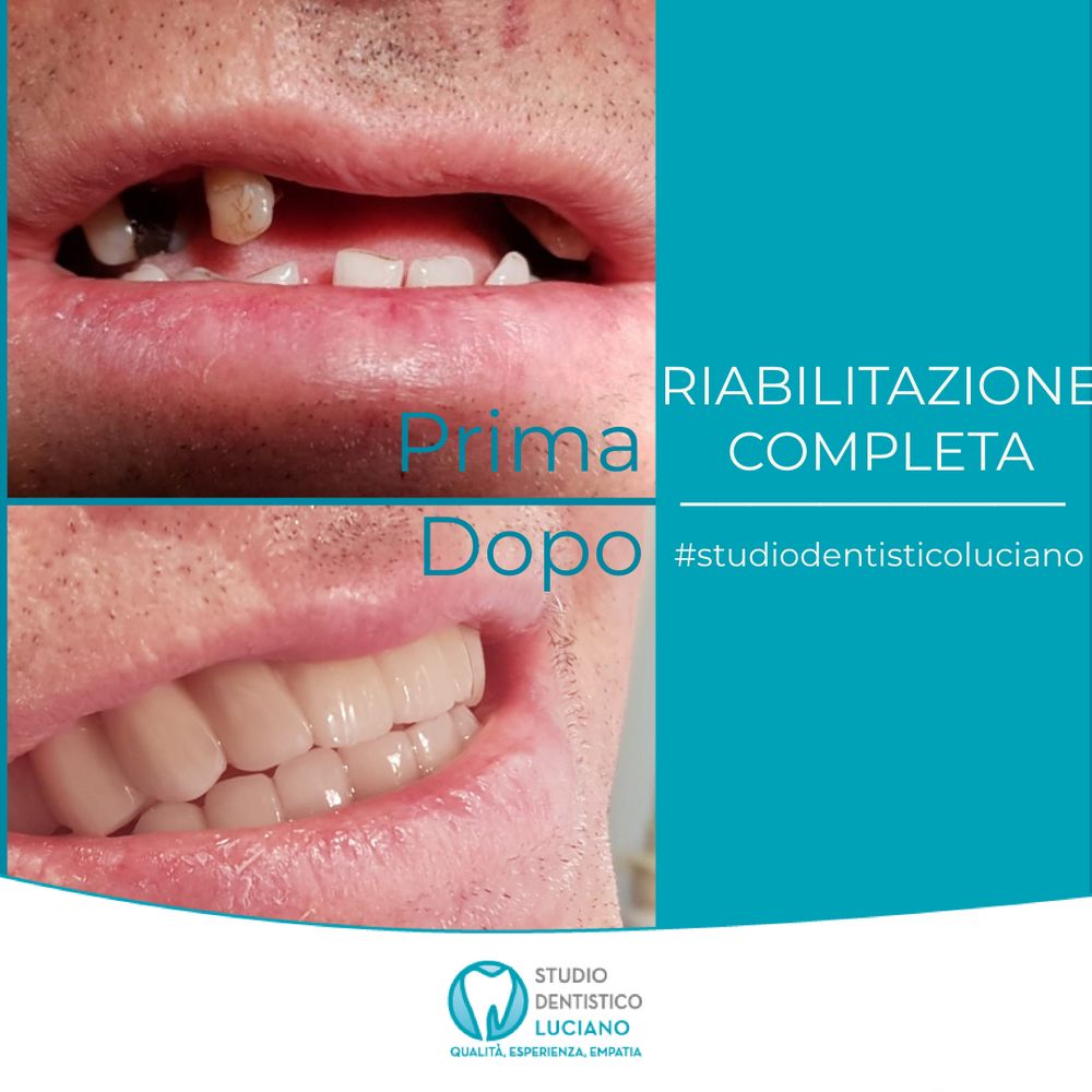 implantologia (3)