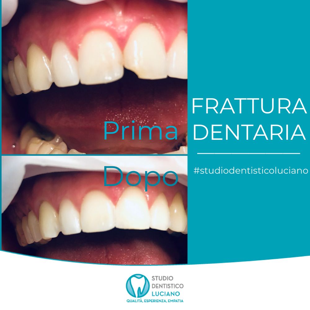 odontoiatria-estetica (2)