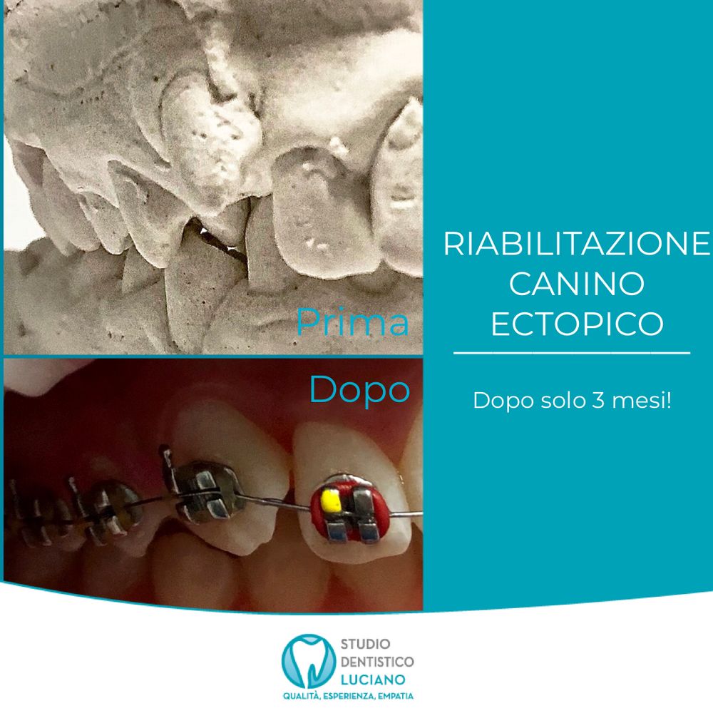 ortodonzia-invisibile-e-tradizionale (1)