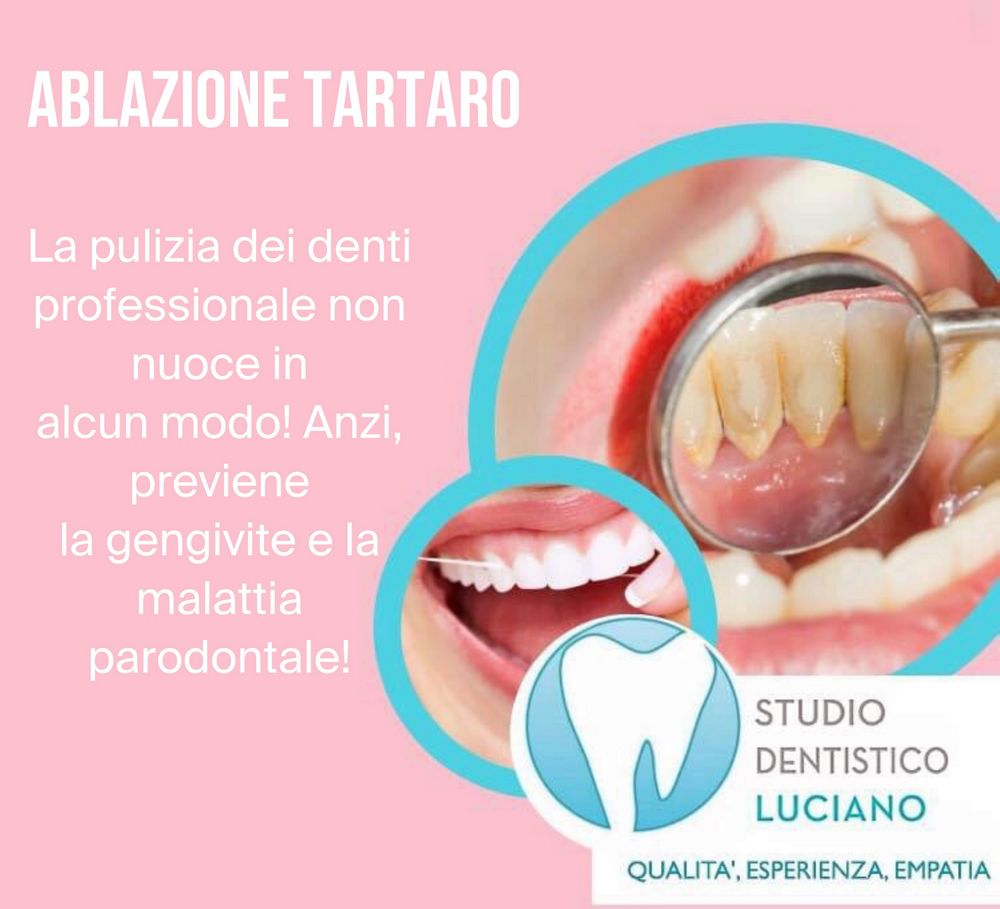 sbiancamento-igiene (1)