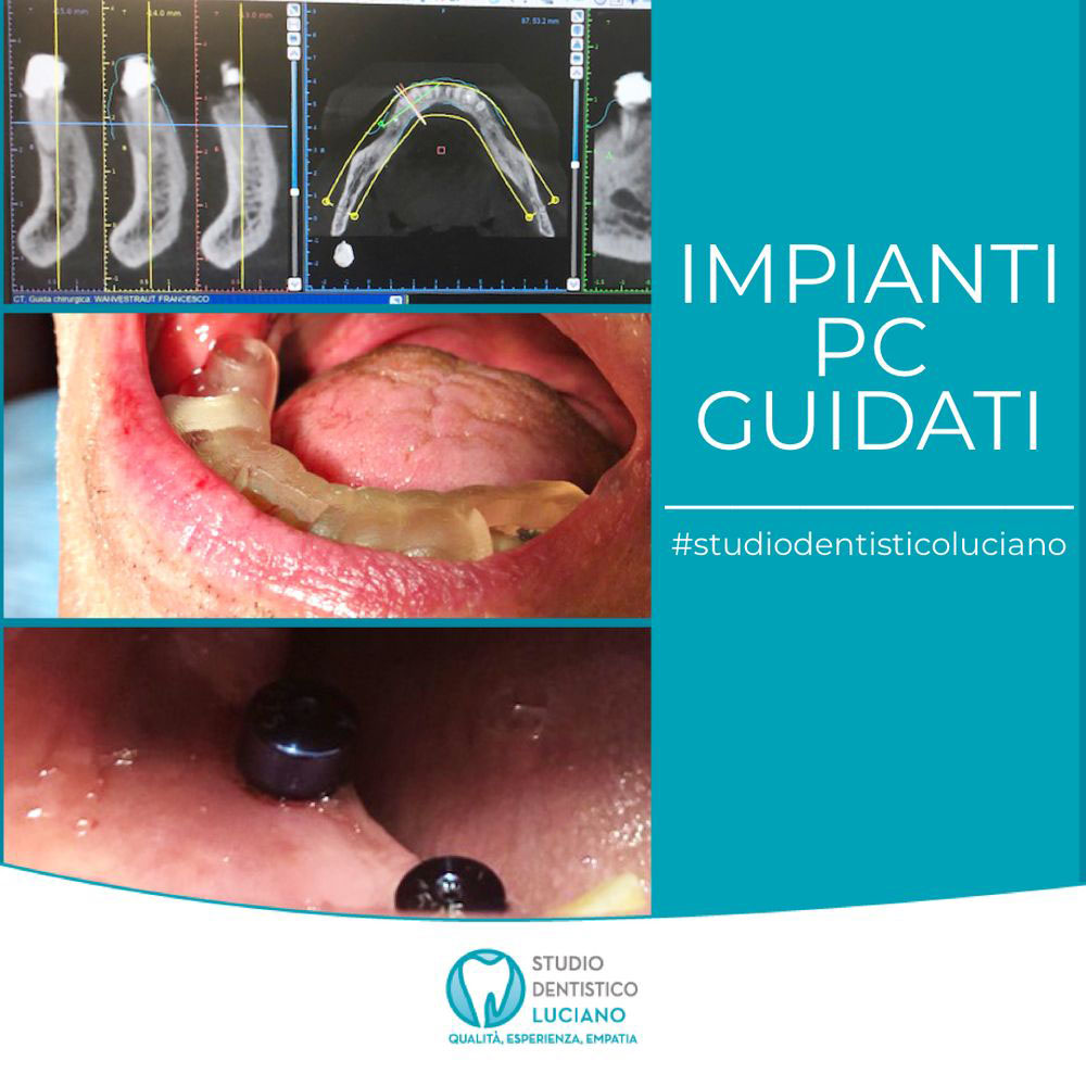implantologia-mod-4